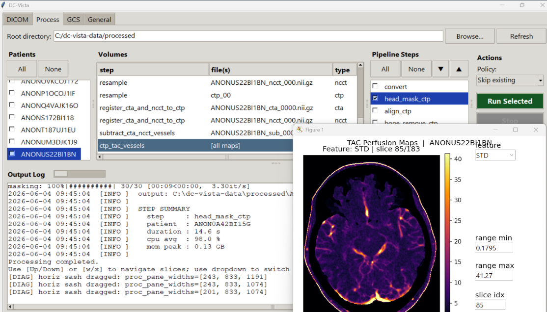 CT perfusion processing pipeline with TAC perfusion map output